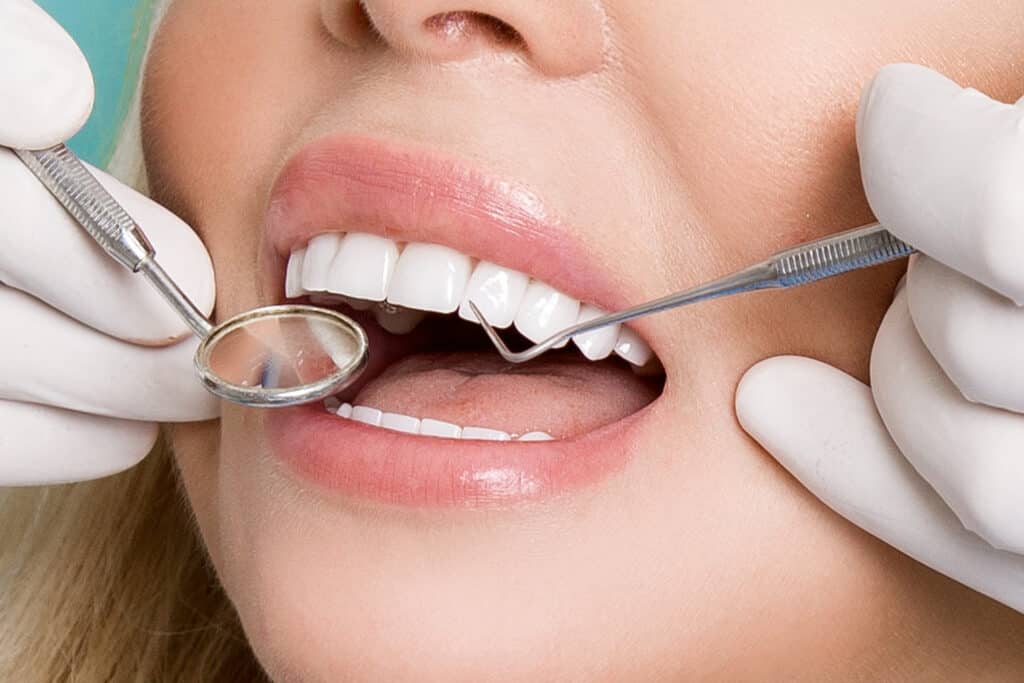 How Do You Prepare For Your Veneers? 5 Steps To Ensure Their Success Prepare for your veneers in Salt Lake City, Utah