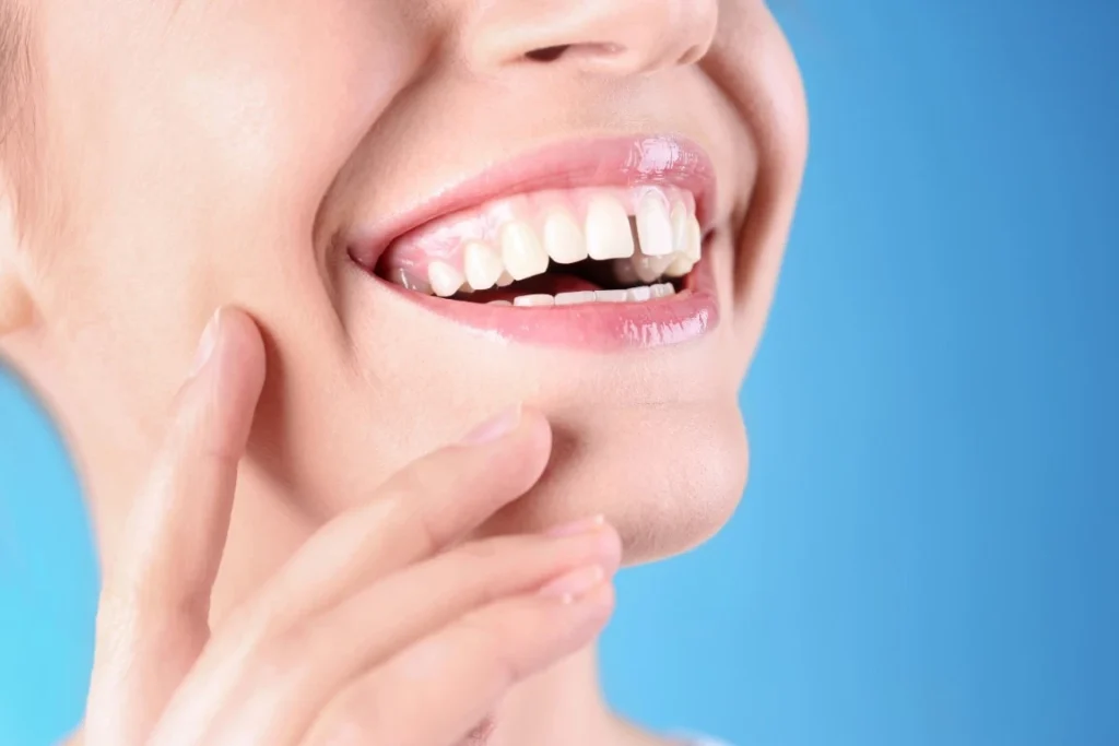 Do You Need To Close A Tooth Gap? A Tooth Gap - Salt Lake City, Utah